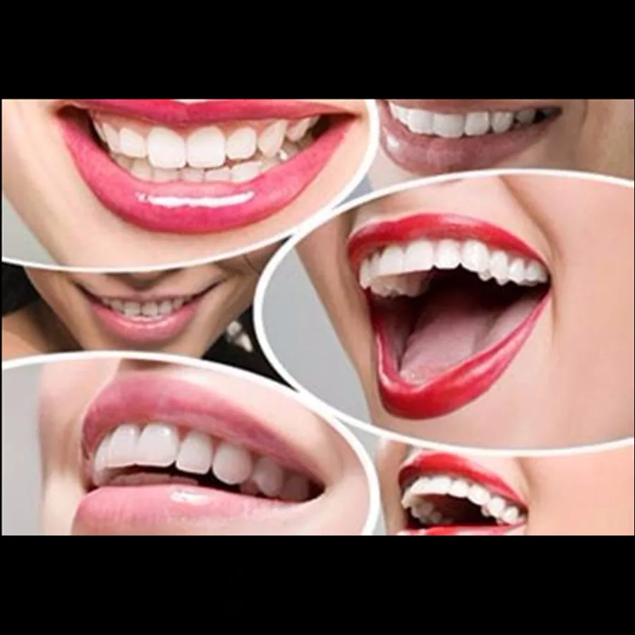 Clareador Стоматологическая одонтология Dentista Dientes гигиена полости рта отбеливатель