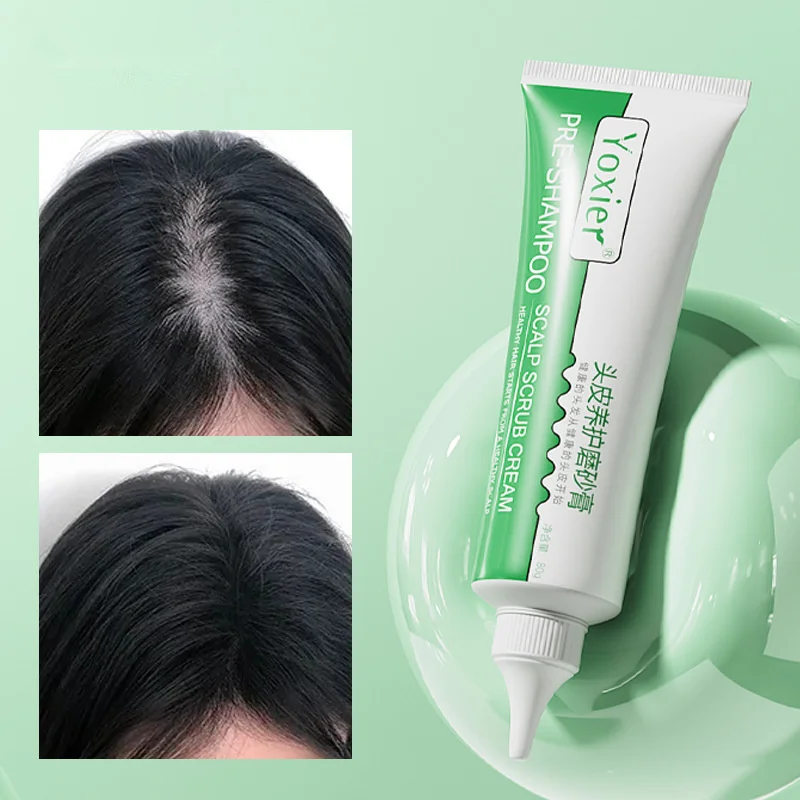 

Hair Thinning Loss Products Pre-Shampoo Scalp Scrub Nourish Remove Dandruff Folliculitis Oil-Control scalp Treatment 80g