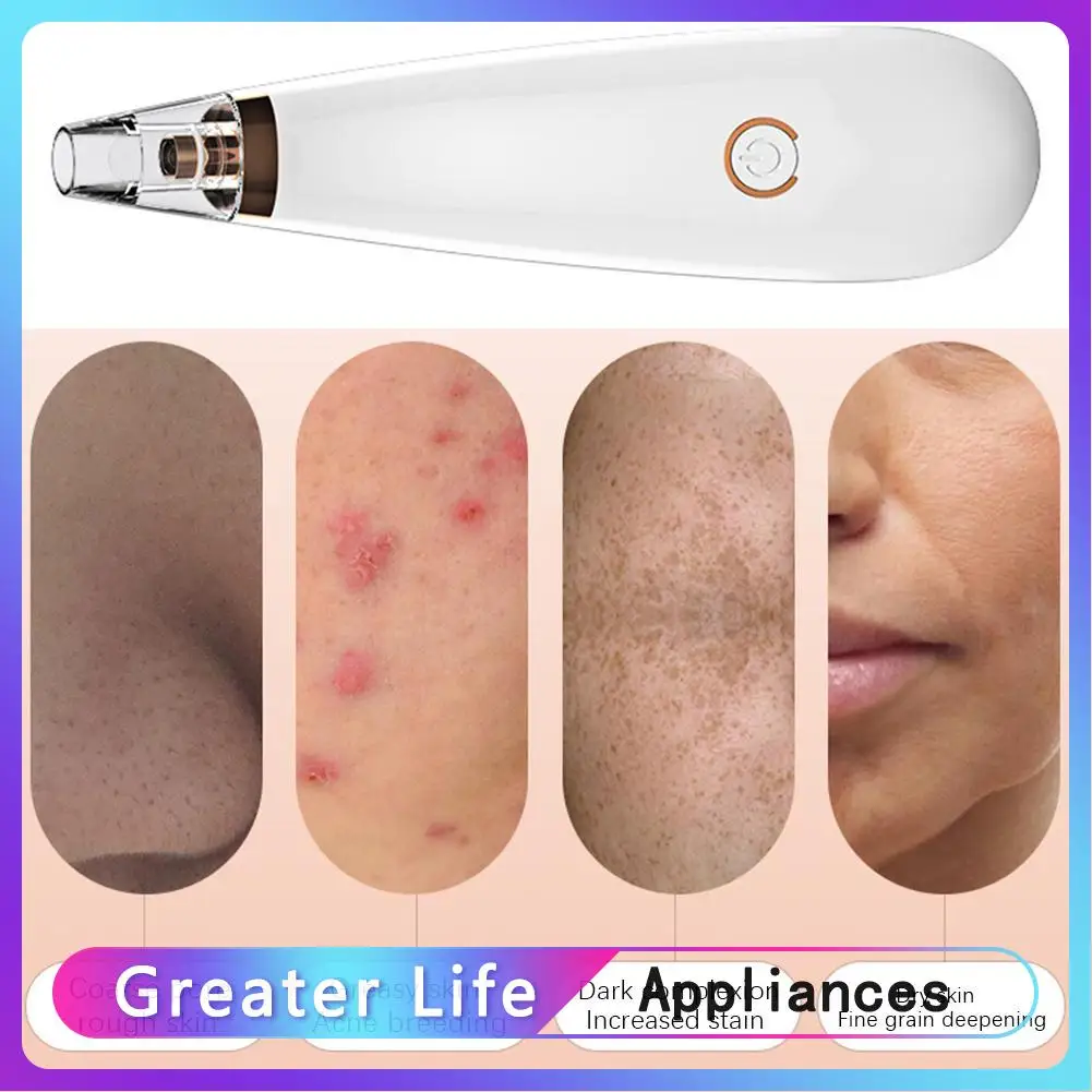 

Electric Blackhead Remover Skin Care Device Face Pore Acne Pimple Removal