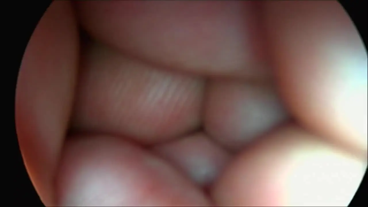 thumb