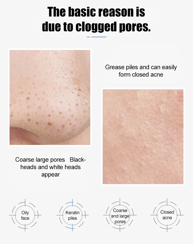 Лактобионовая кислота сыворотка для сужения пор бережное удаление черных точек