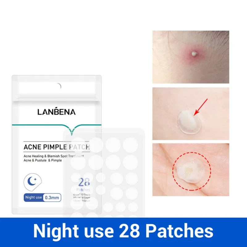 Acne Removal Patch Treatment Mask Anti Acne Stickers Blackhead Pimple Remover Face Washing Product Skin Care H5