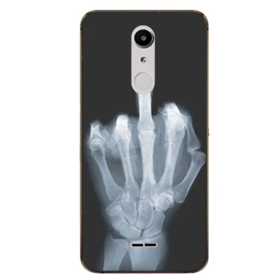 Чехол для смартфона Alcatel 3C 5026D 5026 5026A чехол A3 XL 9008I|Бамперы| |