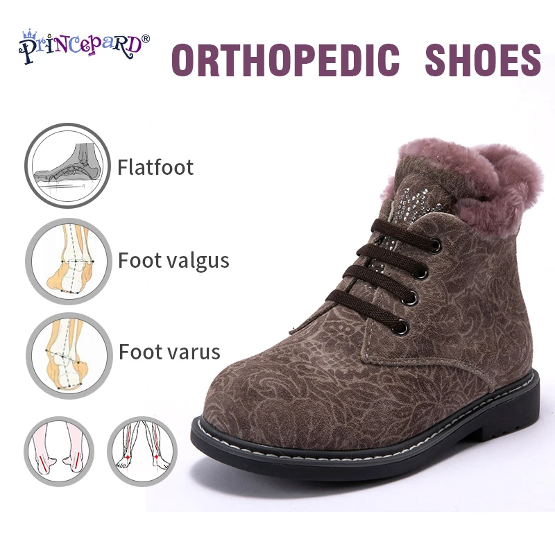Princepard Winter 100% Natural Fur Orthopedic Shoes for Girls Boys 23-28 Size Orthopedic Boots for Kids Soles TPR