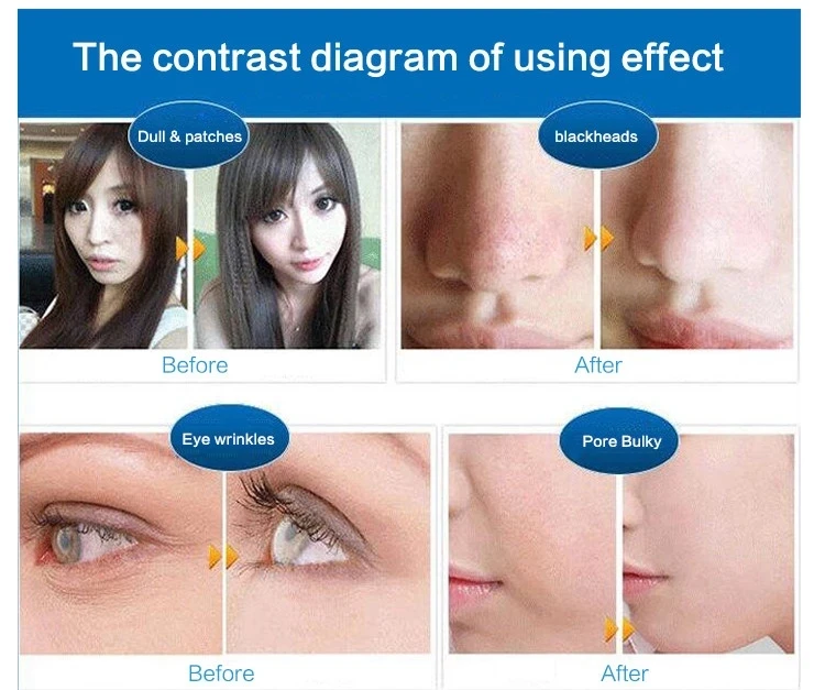 3 в 1 ультразвуковой скребок для кожи лица | Красота и здоровье