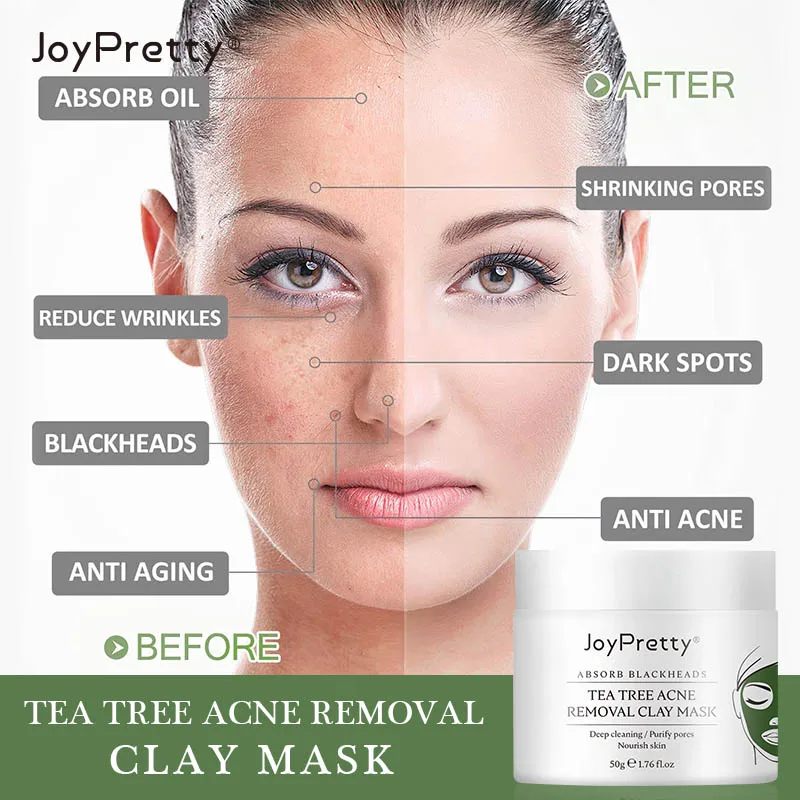 

Cleansing Tea Tree Mask Purifying Clay Stick Mask Oil Control Skin Care Anti-acne Eggplant Skin Care Whitening Mud Mask