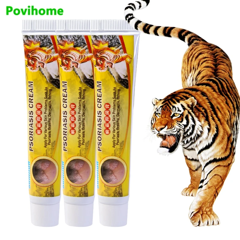 Антибактериальный тигровый бальзам 3 шт. мазь от зуда экземы псориаз дерматит зуд