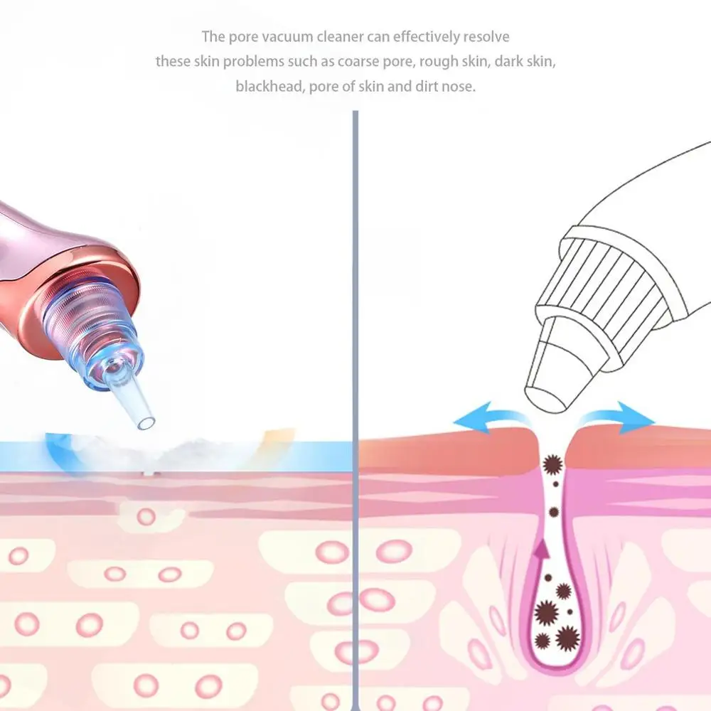 

Vacuum Acne Pimple Removal Diamond Dermabrasion Machine Face Clean Blackhead Remover Skin Care Pore Vacuum Suction Tool Facial