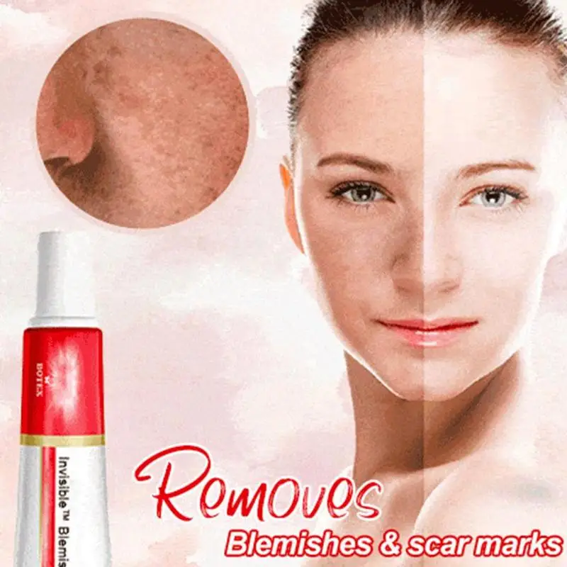 Whitening Freckle Cream Removal Melasma Acne Scar Pigment Melanin Sun Spots Face Care