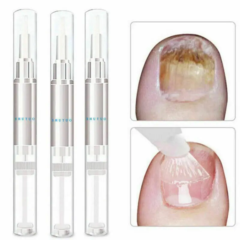 Для женщин 3 мл масло для питания ногтей Расширенный грибковый гвоздь