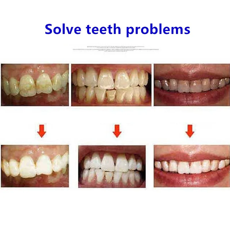 Средство для гигиены полости рта отбеливающая ручка Снежный Топ профессионалов