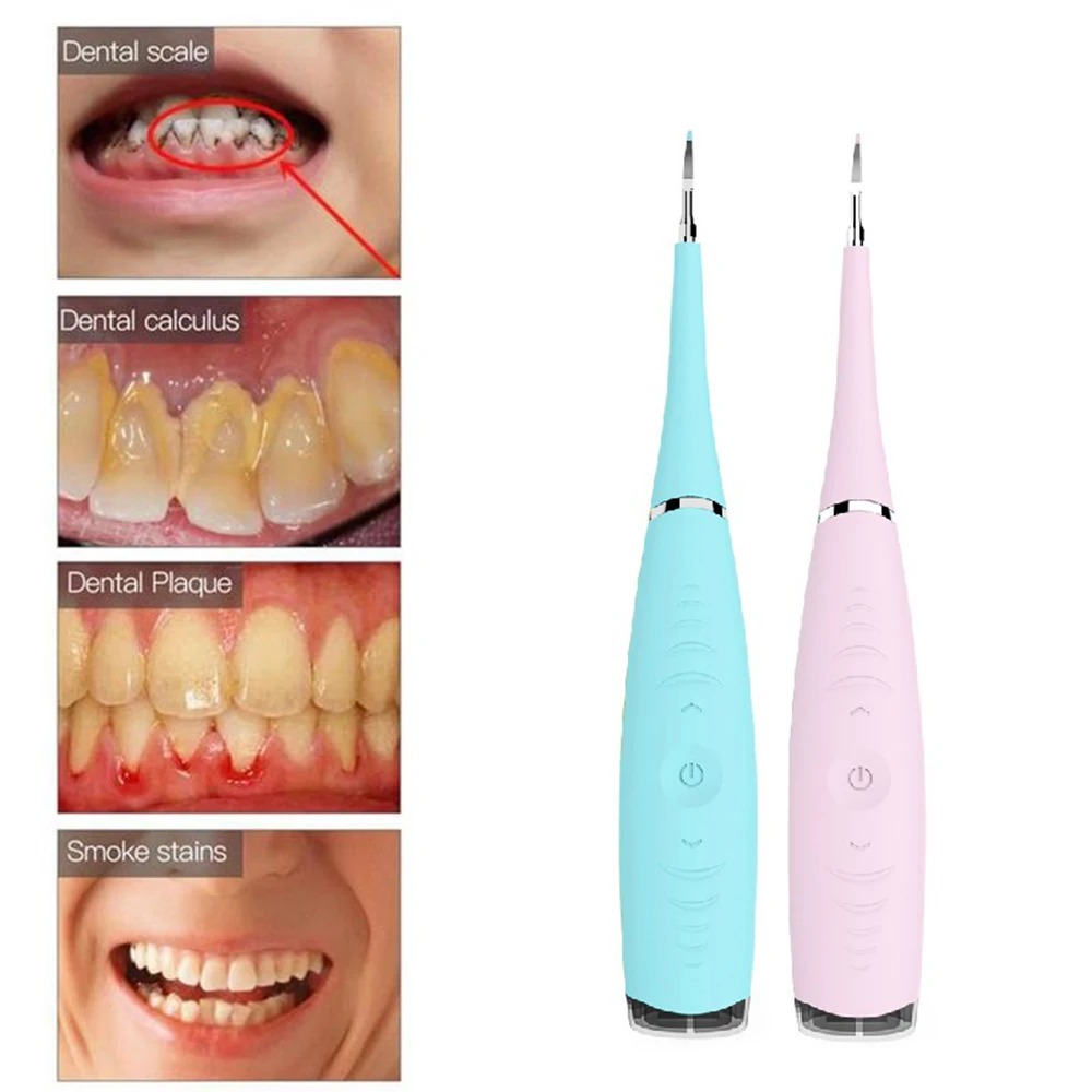 

Electric Dental Calculus Remover High-Frequency Vibration Tartar Scraper Tartar Remover Dental Calculus Tartar Tooth Stains