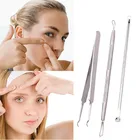 3 шт., пинцет для удаления чёрных точек на лице