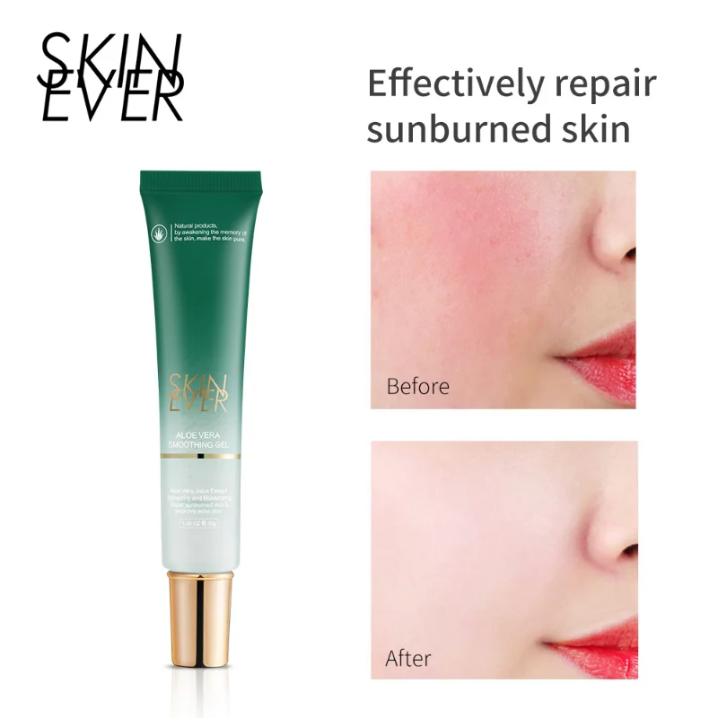 

Aloe Acne Cream Whitening Moisturizing Repair Oil Control Blackhead Acne Facial Cream Treatment Facial Acne Skin Care