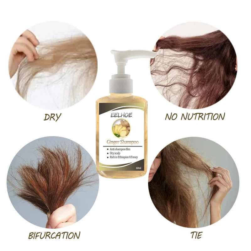 

Shampoo Anti-Hair Loss Shampoo Powerful Treatment Essence Herbs Ginger Cooler Hair Growth Lotions For Men Women