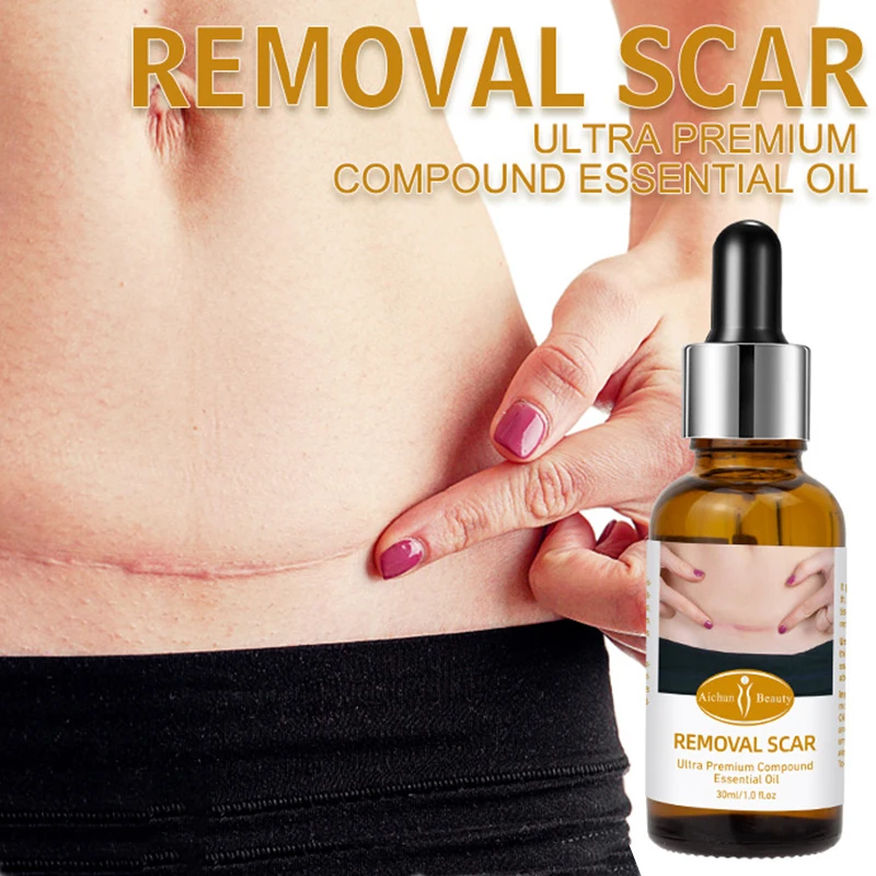 

30 мл восстанавливающее масло от рубцов, эфирное масло для восстановления рубцов, натуральные растительные экстракты, удаление энса, сжиган...