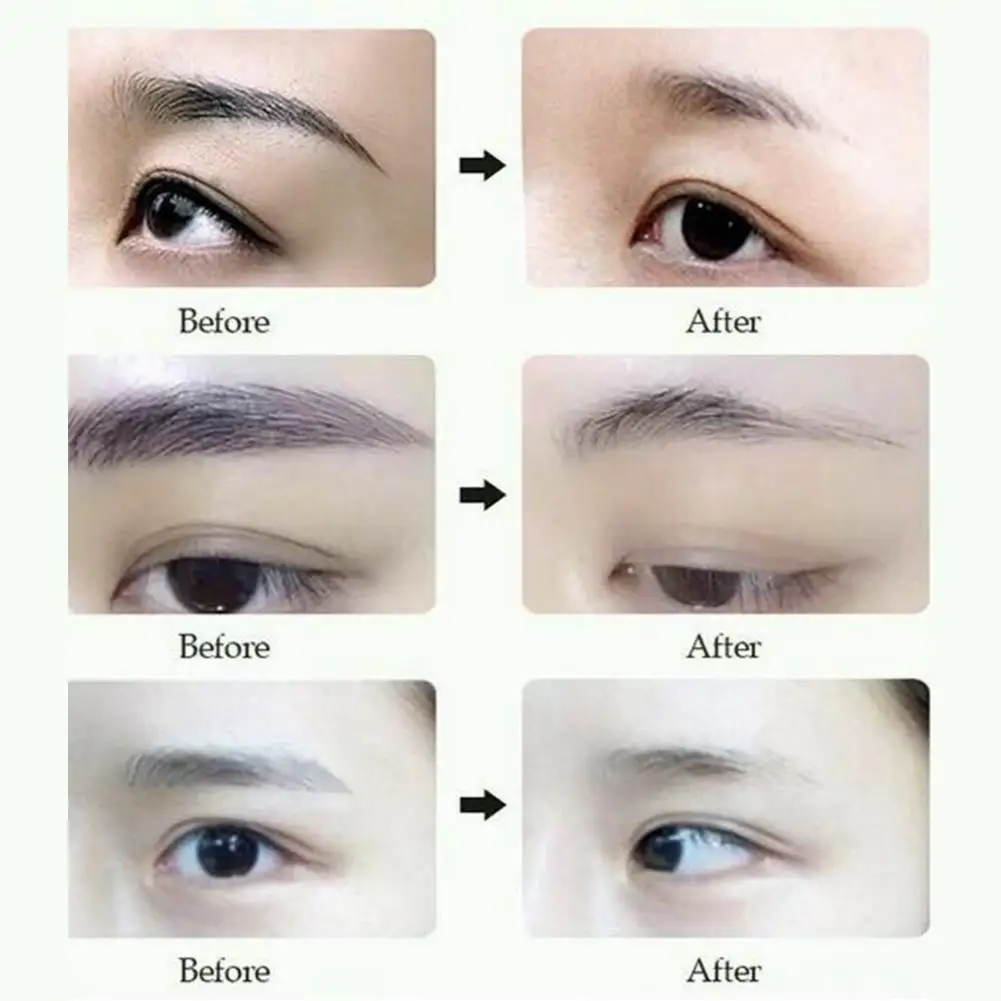 

Permanent Tattoo Removal Cream Tattoo Print Cleansing 100% Safe And Cream Suitable For Most Q5L9