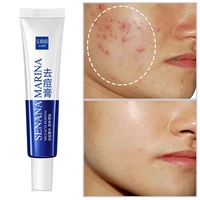 acne removal cream acne pimples treatment gel aloe anti acne fade spots brighten oil control moisturizing shrink pores skin care