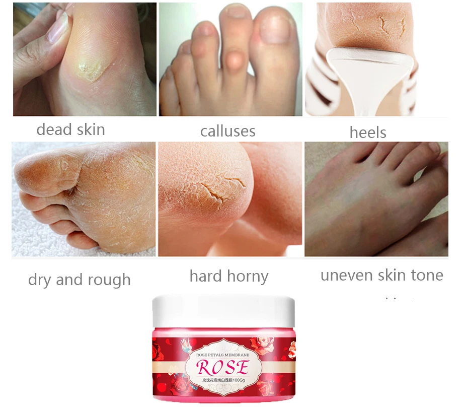 Розовая отшелушивающая маска для ног полумаска стоп удаления омертвевшей кожи