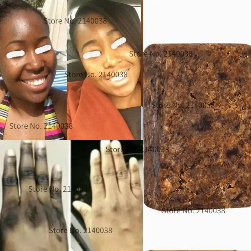 

7 Days Magic Exfoliating African BLACK Soap Beauty Anti Taches Rebelles Beauty Bath Body Clean Treatment Soap Skin Care Handmade