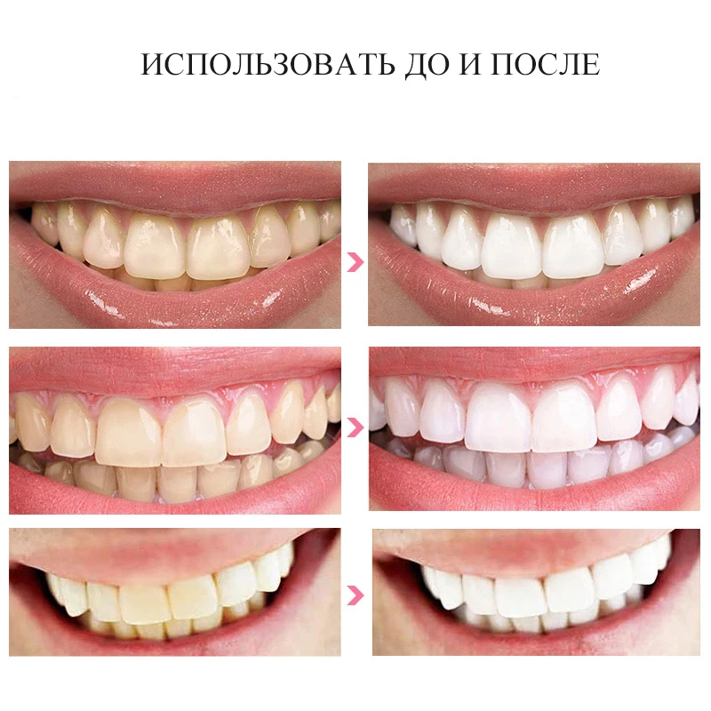 28 шт./14 пар 3D белые гелевые отбеливающие полоски для зубов двойные эластичные полоски для зубов отбеливающие гигиену полости рта уход за зубами отбеливающие инструменты