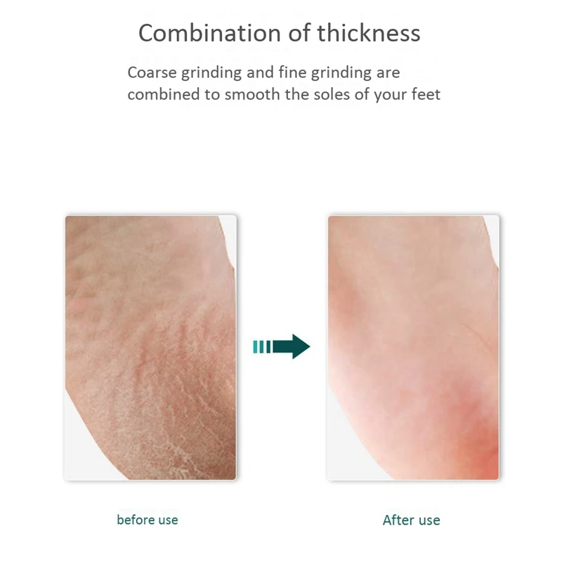 

12Pcs Pedicure Foot File, Coarse/Fine Double Side Cracked Skin Corns Callus Remover Feet Rasp