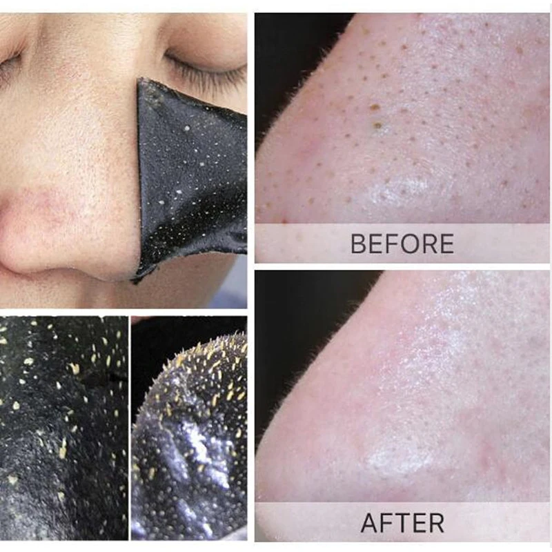 Маска для удаления угрей лица крем ухода за кожей термоусадочные поры акне