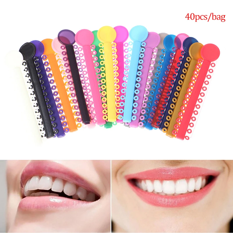 

Dental Oral Orthodontics Elastic Ligature Ties Bands Elastomeric for Orthodontic Brace Brackets 40pcs Ties Rings