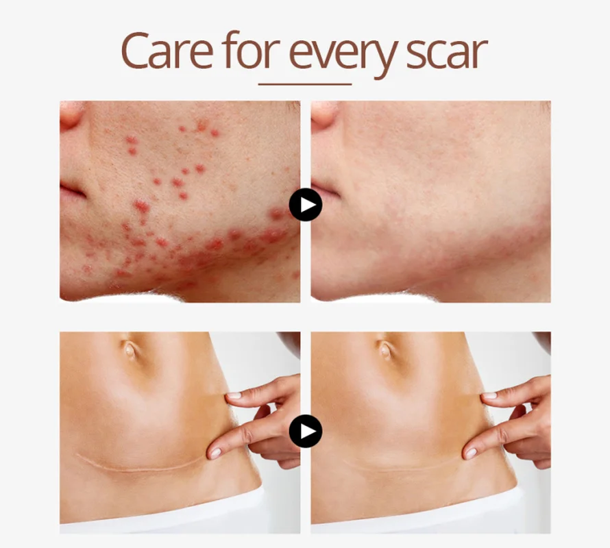 Восстанавливающая кожу крокодиловая кожа искусственная Сыворотка для удаления