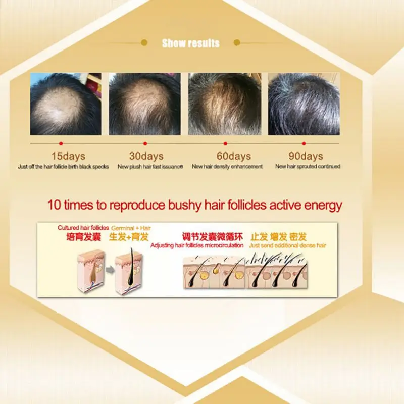 Эфирное масло для роста волос уход за волосами оригинальная сыворотка эссенция