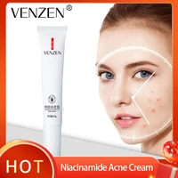 venzen niacinamide acne remover cream acne treatment fade acne spots oil control shrink pores moisturizing repairing skin care