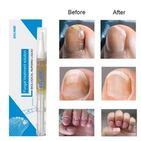 nail repair serum essences fungal care treatments foot nail fungus removal gel anti infective paronychia onychomycosis foot care