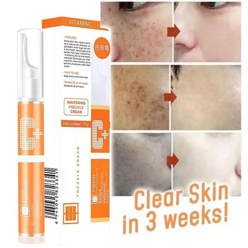 

15g Instant Blemish Removal Gel Vitamin C Whitening Anti Freckle Cream Pen Freckle Removal Pigmented Melanin Spots Face Serum