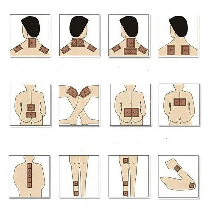 10 шт./пакет медицинский пластырь имбиря Горячая наклейка артрита боли в суставах