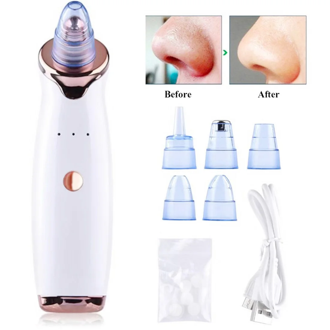 Ультразвуковой пилинг для лица скраб кожи очищающий вакуумный от акне черных