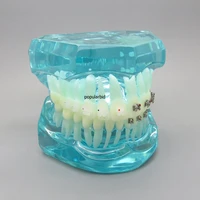 dental orthodontics model 4 types of brackets communication model dentist patient communication teeth model