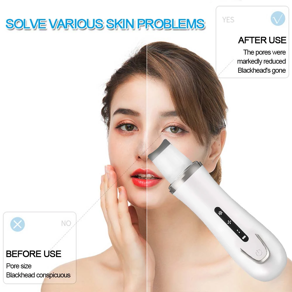 Facial Skin Scrubber Blackhead Remover Ultrasonic Face Deep Pore Acne Cleaner Spatula Face Lifting Whitening Massager Skin Care