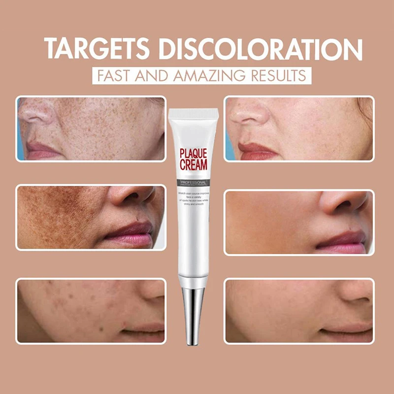 

Whitening Freckle Cream Remove Melasma Acne Spot Pigment Dark Spots Skin Care