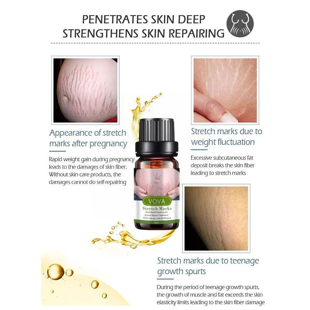 

10ml Stretch Marks Remover Essential Oil Treatment Slackline Oils Maternity Skin For Pregnant For Stretch Essential Oil Pouch
