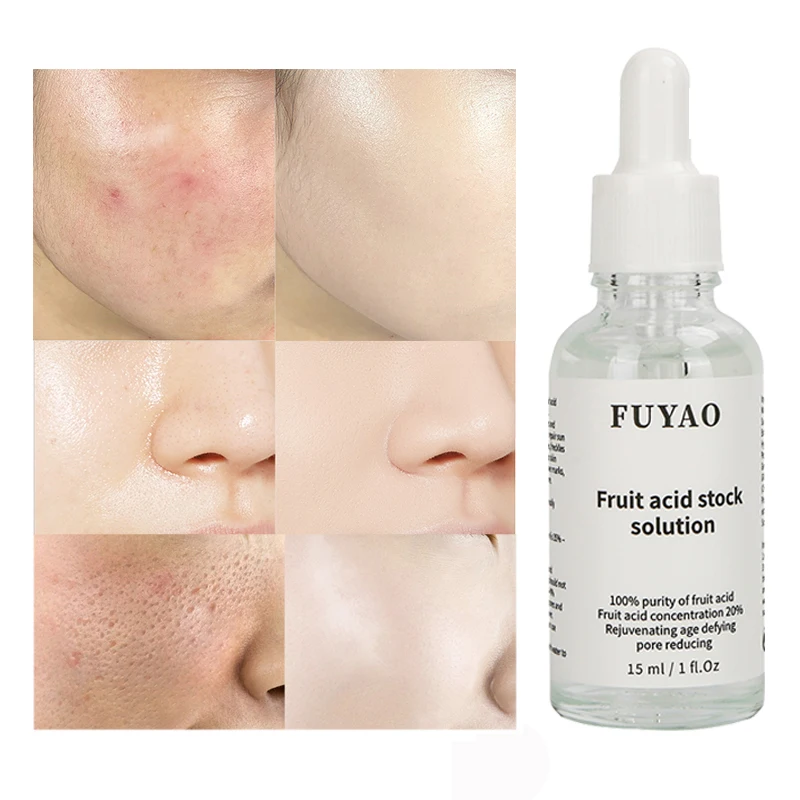 Acido glicolico 100% pelle buccia acido chimico buccia trattare l'acne ridurre i segni di Acne ridurre i pori e rigenerare la pelle acido ialironico