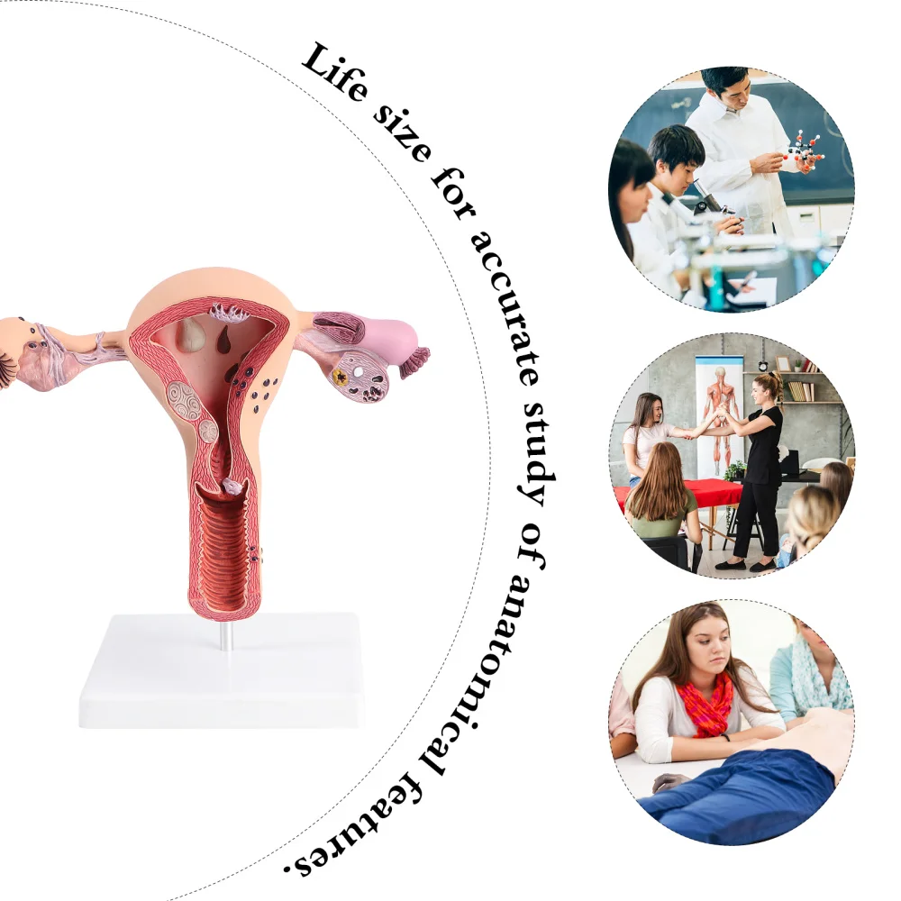 

1Pc Practical Uterus Model Female Reproductive System Model for Training