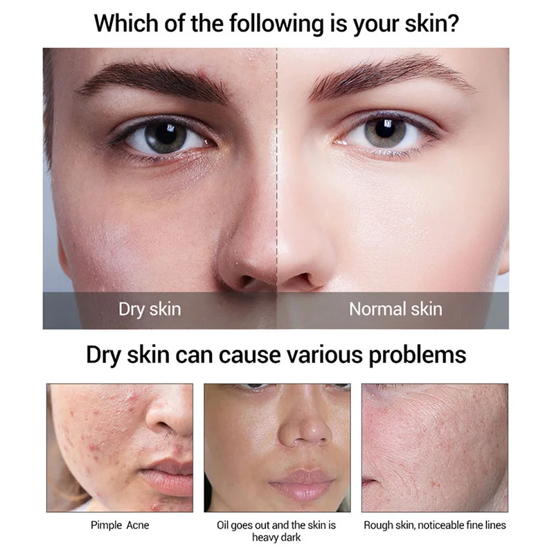 Увлажняющая увлажняющая сыворотка B5 с гиалуроновой кислотой высокими