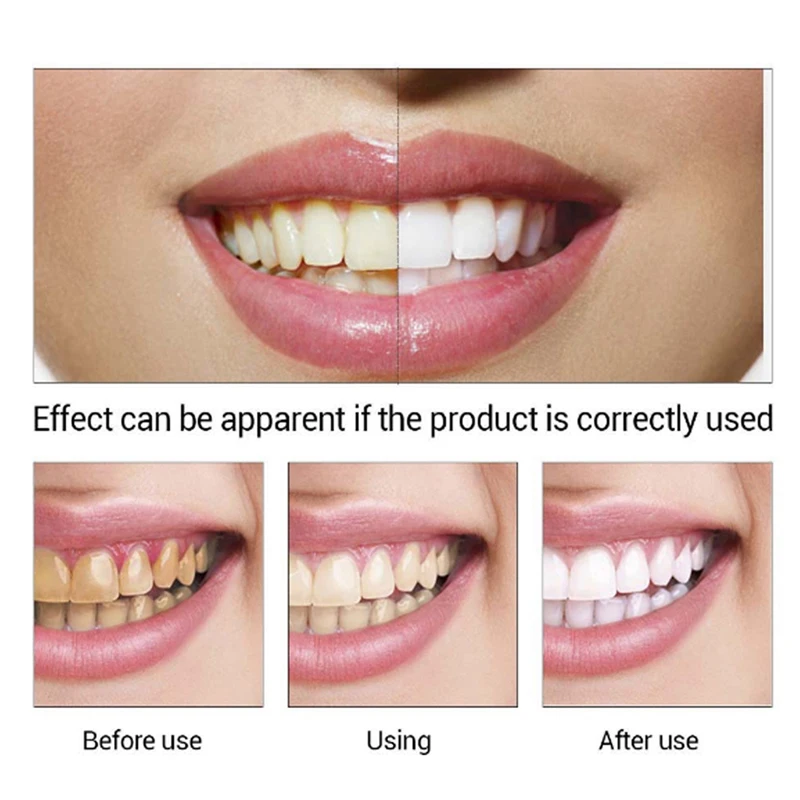 Teeth Whitening Essence Remove Serum Plaque Stains Brighten Bleaching Tooth Liquid Oral Hygiene Care Cleaner Healthy | Красота и