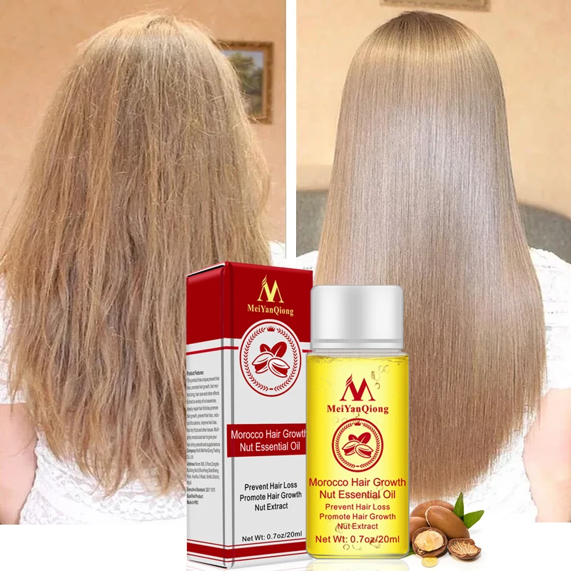 

Fast Powerful Hair Growth Essence Hair Loss Products Essential Oil Liquid Treatment Preventing Hair Loss Hair Care Products 20ml
