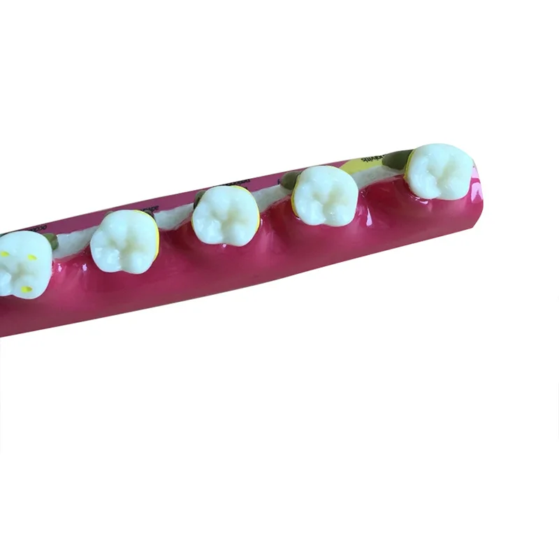 Стоматологическая модель зубов Пародонтоз ассортная классификации зубов|dental