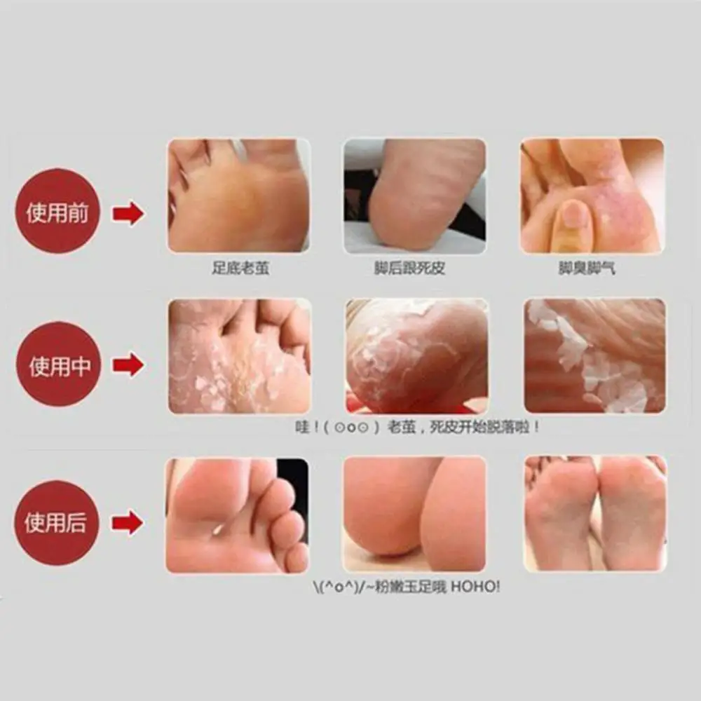 1 упаковка = 2 шт. маска для удаления омертвевшей кожи|heel feet|dead skin foot maskfoot mask |