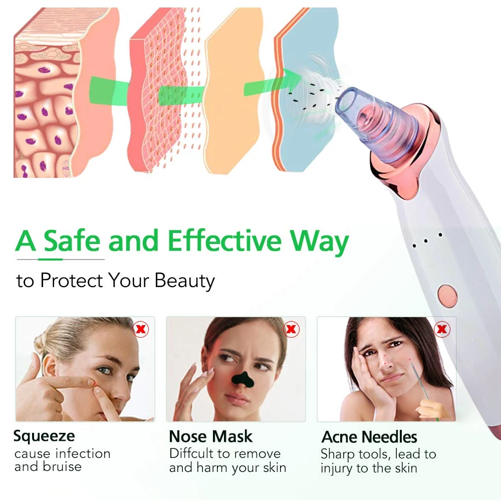 Для удаления угрей пылесос в черный горошек для маленьких девочек чистки лица