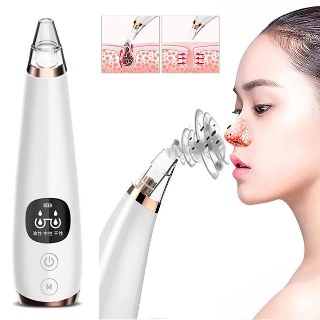 Женский электрический прибор для удаления черных точек с присоской черный 150 мин