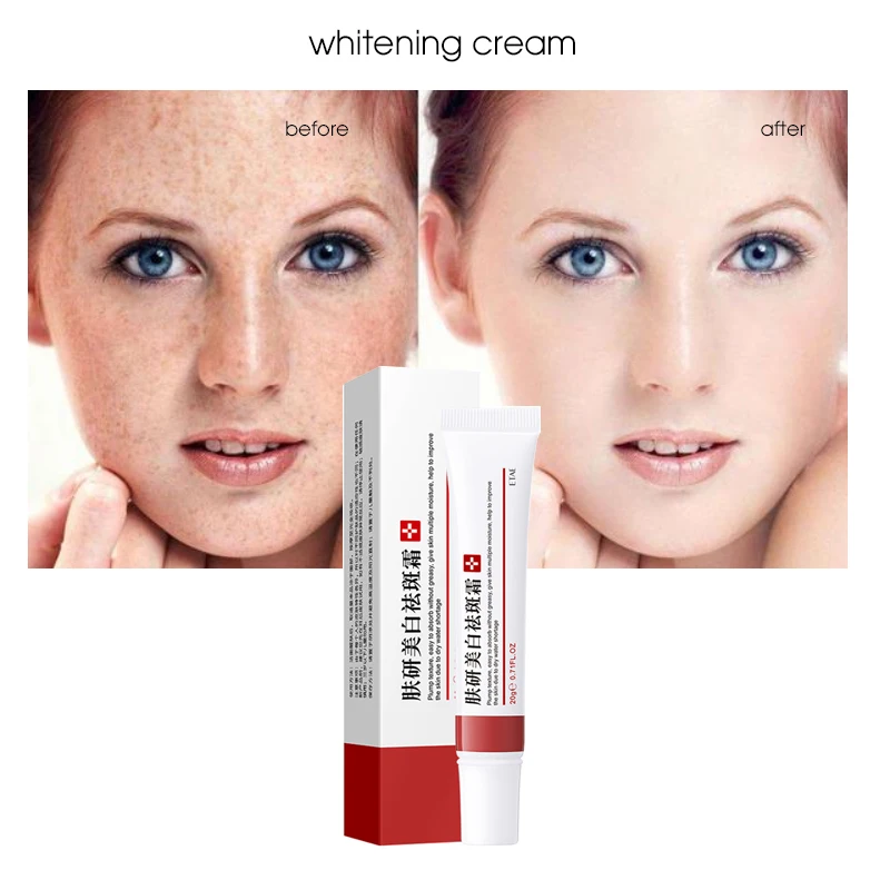 Отбеливающий крем ianna для удаления акне коррекции черно-желтой кожи веснушек