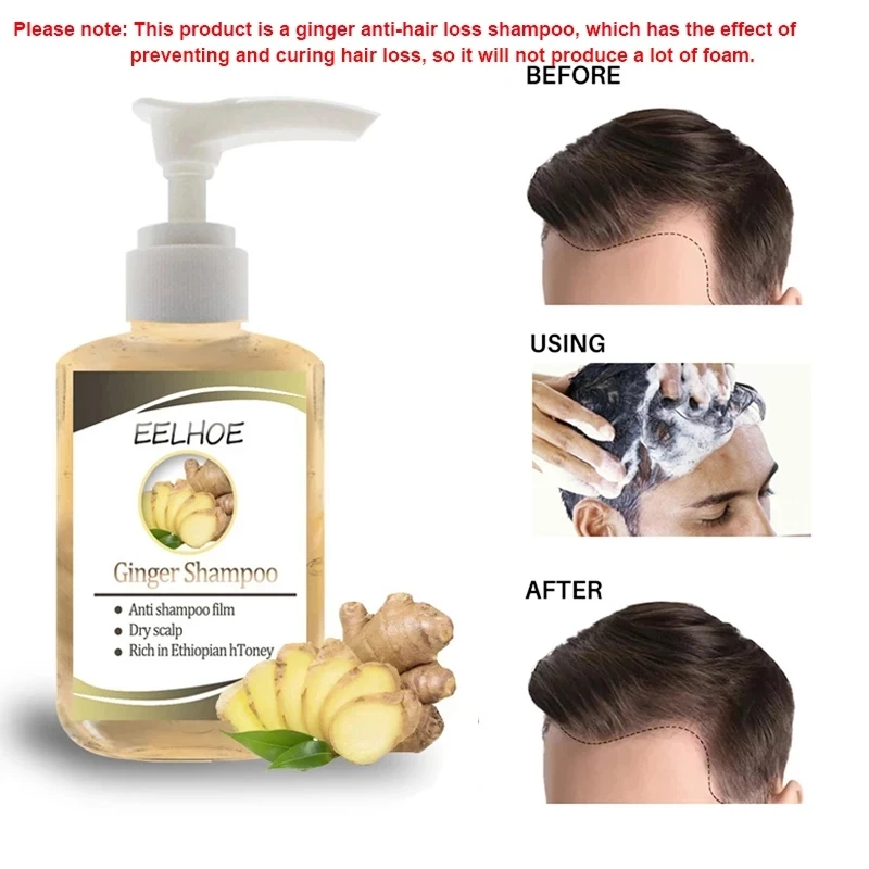 

Ginseng Anti-Hair Loss Shampoo Powerful Treatment Essence Herbs Ginger Cooler Hair Growth Lotions for Men Women